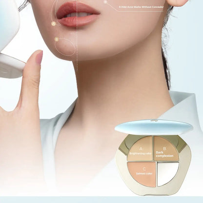 TIMAGE Concealer 2.0 – Cover Spots, Acne, Dark Circles & Brighten